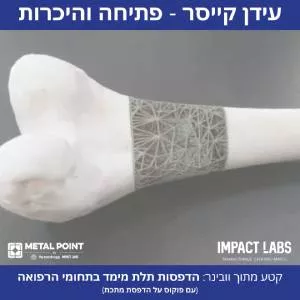 הדפסה תלת מימדית עבור אפליקציות בתחום הרפואה - קטע ראשון